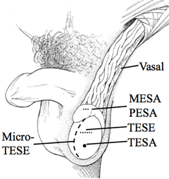 mesa-pesa-test-tesa